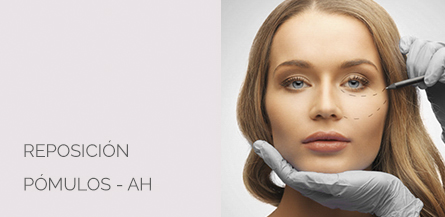 Reposicion pómulos Centro Médico Estético AYC Soria
