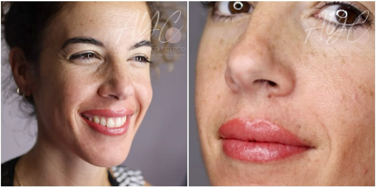 Micropigmentación avanzada de labios en Soria, en Centro Médico Estético AYC