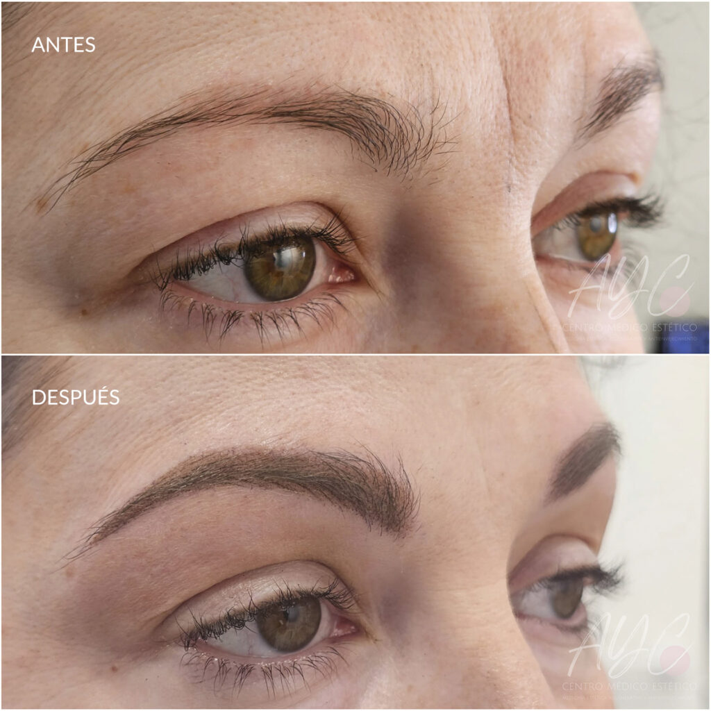 Micropigmentación de cejas en AYC Soria, Centro médico estético