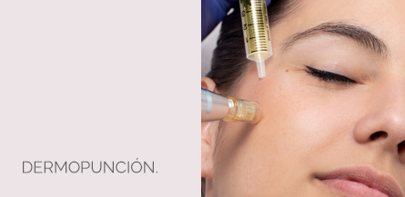 dermopuncion Centro Médico Estético AYC Soria