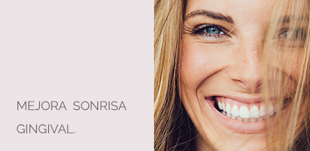 Sonrisa Gingival Centro Médico Estético AYC Soria