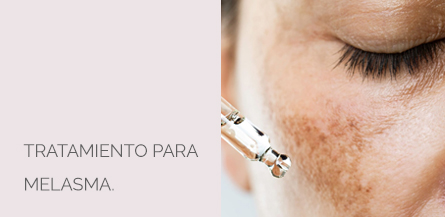 Tratamiento Melasma Centro Médico Estético AYC Soria