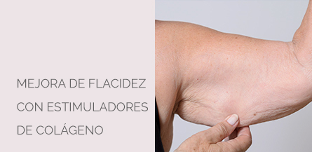 Centro Médico Estético AYC Soria Flacidez con colágeno