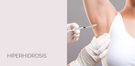 centro-medico-estetico-ayc-hiperhidrosis