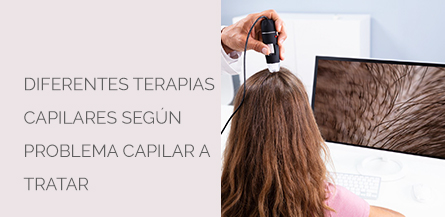 Tratamiento Capilar Centro Médico Estético AYC Soria