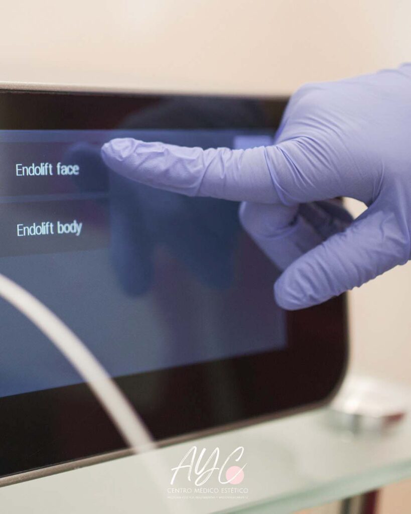  Aplicación de tecnología médico-estética avanzada para flacidez facial en Soria.