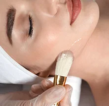 Peeling QuÍmico facial