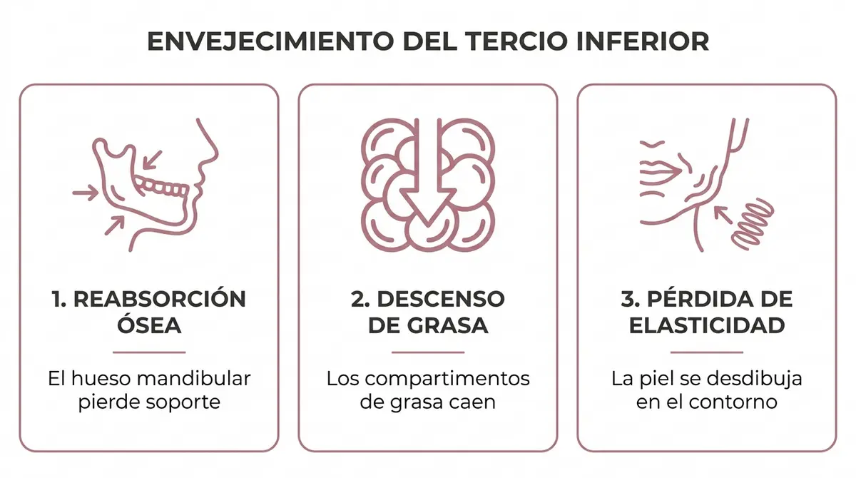 Infografía explicativa del proceso de envejecimiento y pérdida de definición en el tercio inferior del rostro.